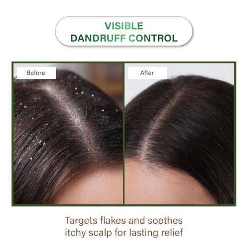 Niconi Herbal Hair Oil | Suitable for Men & Women | Applicator Bottle|Helps Reduce Hair Fall & Dandruff | Contains Coconut, Rosemary, Castor, Bhringraj, Eucalptus, Shikakai, Methi, Bhrami, Neem Oil | 200ml - Image 3