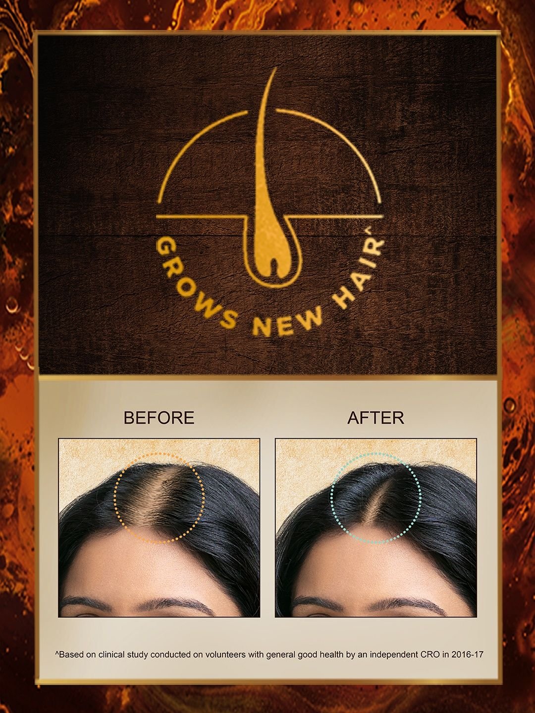 indulekha Bringha Hair Oil with Amla & Almond to Reduce Hair Fall & Grow New Hair - 120 ml - Image 2